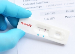 Xét nghiệm HIV và những điều cần lưu ý