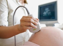 Siêu âm thai 3D, 4D phát hiện dị tật thai nhi sớm