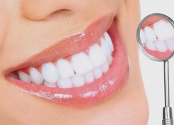 Trồng Răng, Nhổ Răng, Răng Sứ Thẩm Mỹ: Giải Pháp Nhanh Chóng Cho Nụ Cười Đẹp Hơn