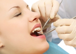 Nhổ răng, trám răng và các vấn đề liên quan sức khỏe răng miệng